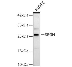 Western Blot - Anti-Serglycin Antibody (A329839) - Antibodies.com