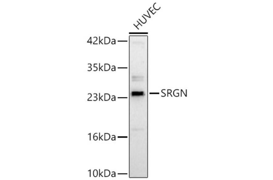 Western Blot - Anti-Serglycin Antibody (A329839) - Antibodies.com