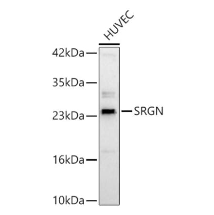 Western Blot - Anti-Serglycin Antibody (A329839) - Antibodies.com