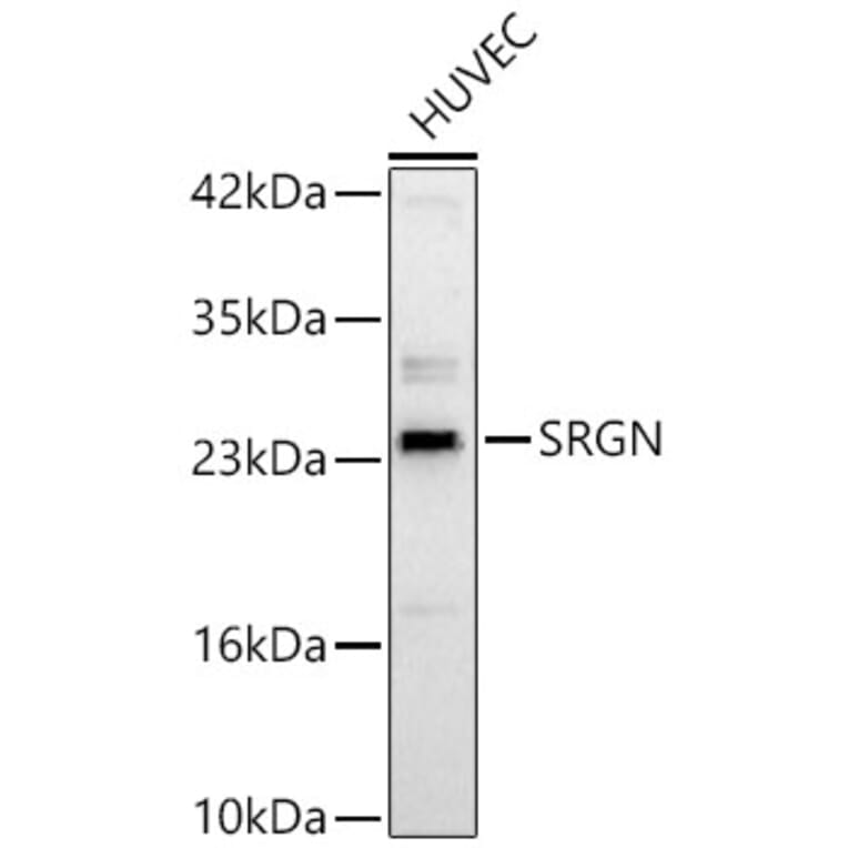 Western Blot - Anti-Serglycin Antibody (A329839) - Antibodies.com