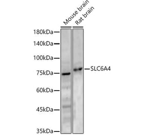 Western Blot - Anti-Serotonin Transporter Antibody (A329840) - Antibodies.com