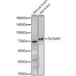 Western Blot - Anti-Serotonin Transporter Antibody (A329840) - Antibodies.com