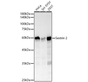 Western Blot - Anti-Sestrin 2 Antibody [ARC61316] (A329841) - Antibodies.com