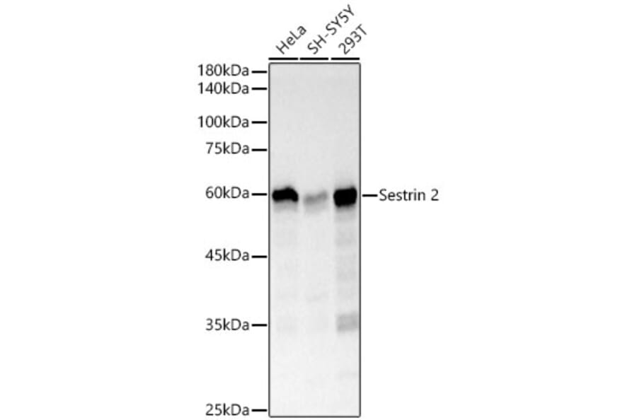 Western Blot - Anti-Sestrin 2 Antibody [ARC61316] (A329841) - Antibodies.com