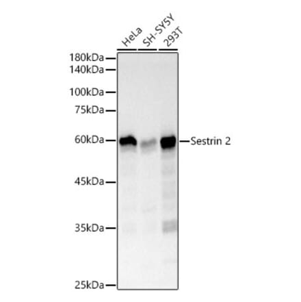 Western Blot - Anti-Sestrin 2 Antibody [ARC61316] (A329841) - Antibodies.com