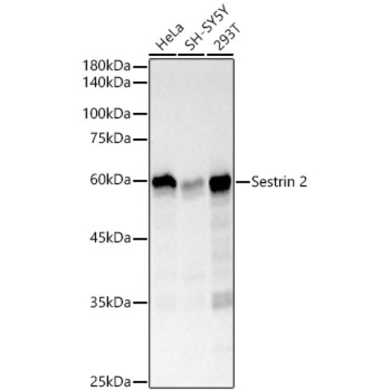 Western Blot - Anti-Sestrin 2 Antibody [ARC61316] (A329841) - Antibodies.com