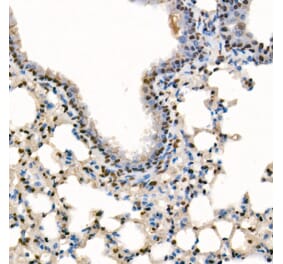 Immunohistochemistry - Anti-SETD1B Antibody (A329842) - Antibodies.com