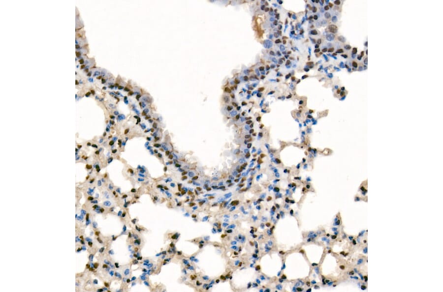 Immunohistochemistry - Anti-SETD1B Antibody (A329842) - Antibodies.com