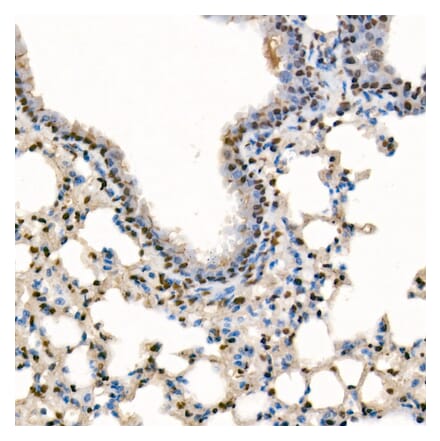 Immunohistochemistry - Anti-SETD1B Antibody (A329842) - Antibodies.com