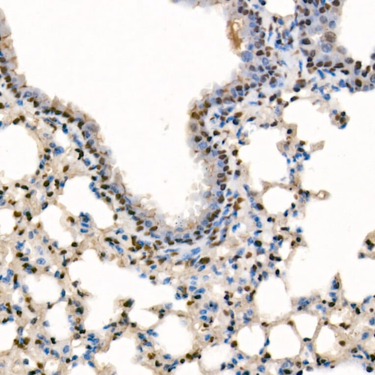 Immunohistochemistry - Anti-SETD1B Antibody (A329842) - Antibodies.com