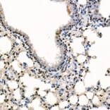 Immunohistochemistry - Anti-SETD1B Antibody (A329842) - Antibodies.com