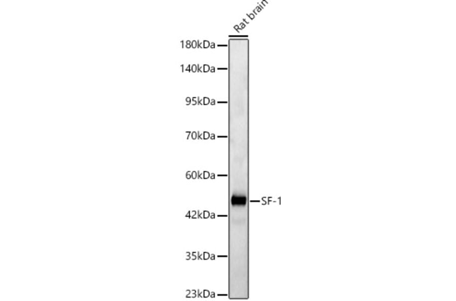 Western Blot - Anti-SF-1 Antibody (A329843) - Antibodies.com