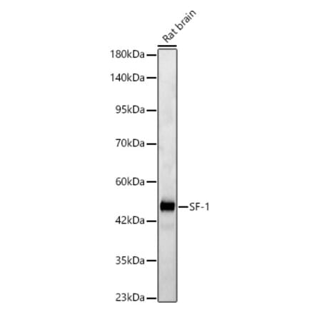 Western Blot - Anti-SF-1 Antibody (A329843) - Antibodies.com
