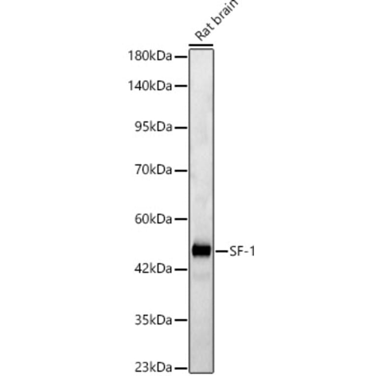 Western Blot - Anti-SF-1 Antibody (A329843) - Antibodies.com