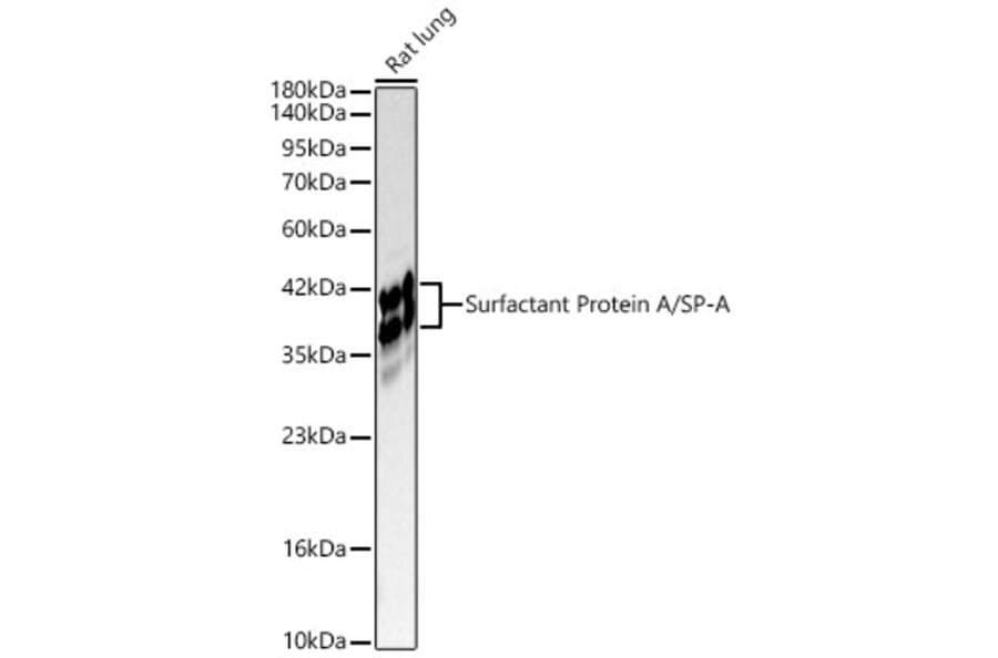 Western Blot - Anti-SFTPA1 Antibody (A329844) - Antibodies.com