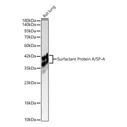 Western Blot - Anti-SFTPA1 Antibody (A329844) - Antibodies.com