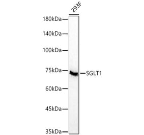 Western Blot - Anti-SGLT1 Antibody [ARC60248] (A329845) - Antibodies.com