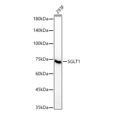 Western Blot - Anti-SGLT1 Antibody [ARC60248] (A329845) - Antibodies.com