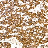 Immunohistochemistry - Anti-SGPL1 Antibody (A329846) - Antibodies.com