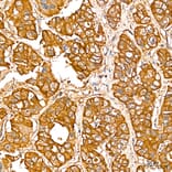 Immunohistochemistry - Anti-SGPL1 Antibody (A329846) - Antibodies.com