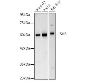 Western Blot - Anti-SHB Antibody [ARC3191] (A329847) - Antibodies.com