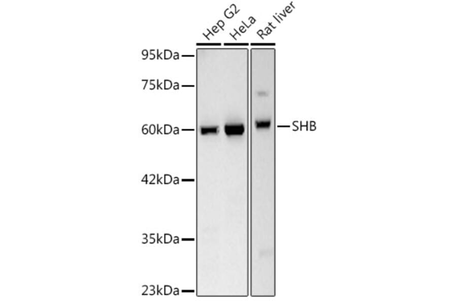 Western Blot - Anti-SHB Antibody [ARC3191] (A329847) - Antibodies.com