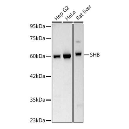 Western Blot - Anti-SHB Antibody [ARC3191] (A329847) - Antibodies.com