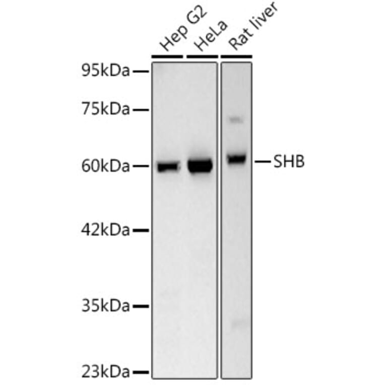 Western Blot - Anti-SHB Antibody [ARC3191] (A329847) - Antibodies.com