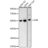 Western Blot - Anti-SHB Antibody [ARC3191] (A329847) - Antibodies.com