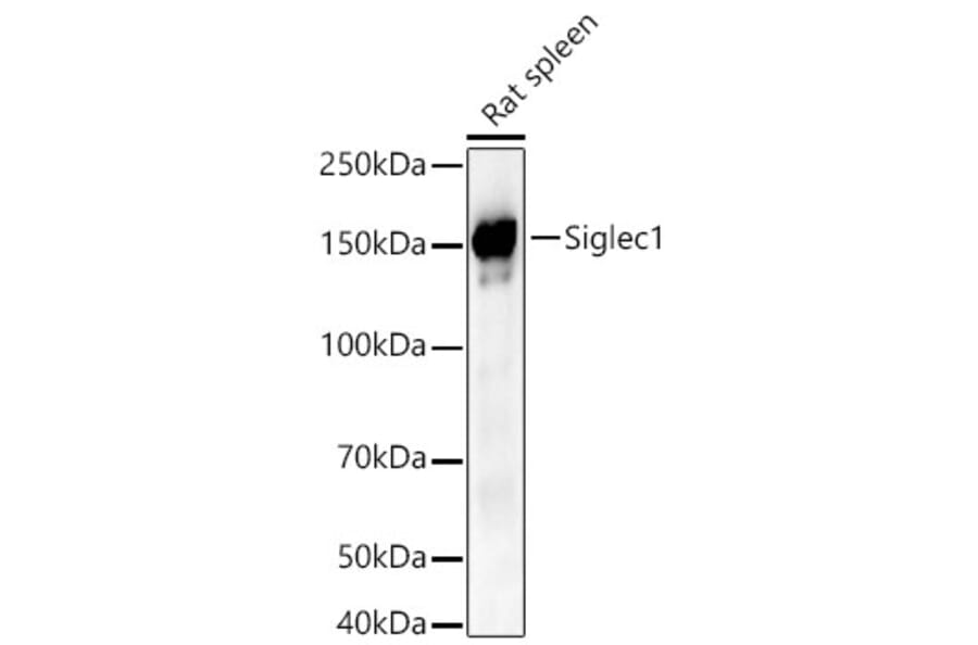 Western Blot - Anti-Siglec1 Antibody (A329848) - Antibodies.com
