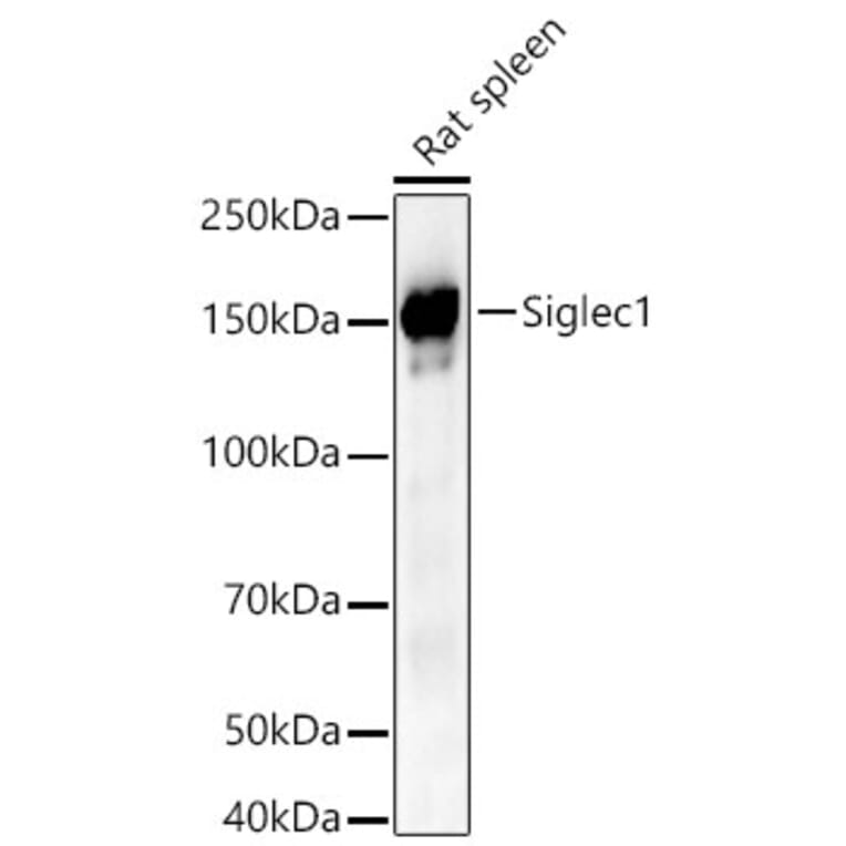 Western Blot - Anti-Siglec1 Antibody (A329848) - Antibodies.com
