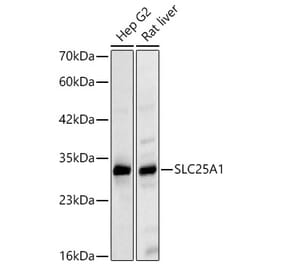 Western Blot - Anti-SLC25A1 Antibody (A329851) - Antibodies.com