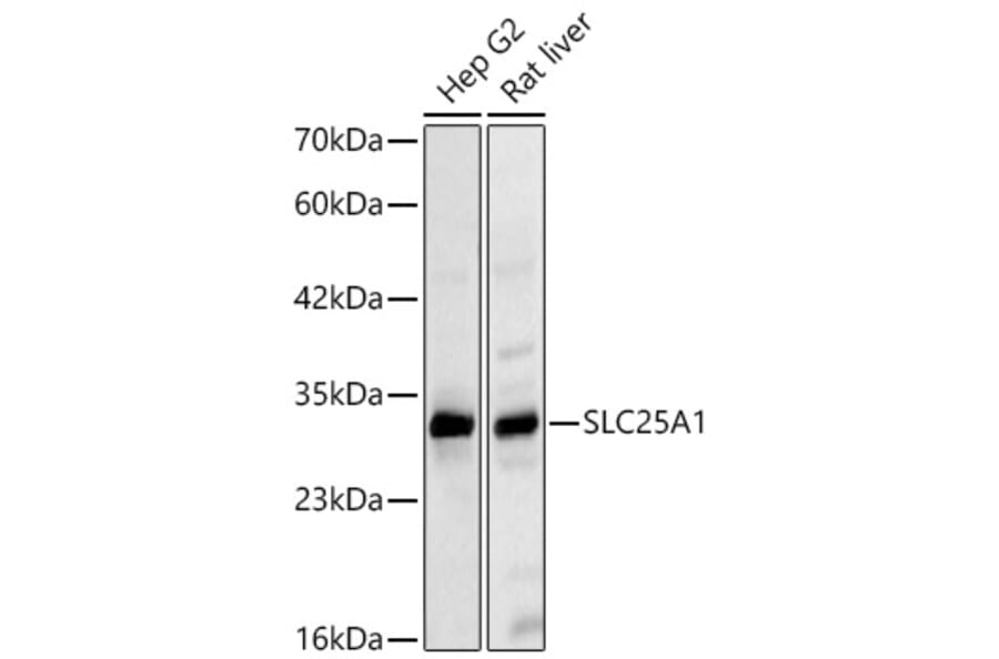 Western Blot - Anti-SLC25A1 Antibody (A329851) - Antibodies.com