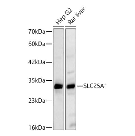 Western Blot - Anti-SLC25A1 Antibody (A329851) - Antibodies.com