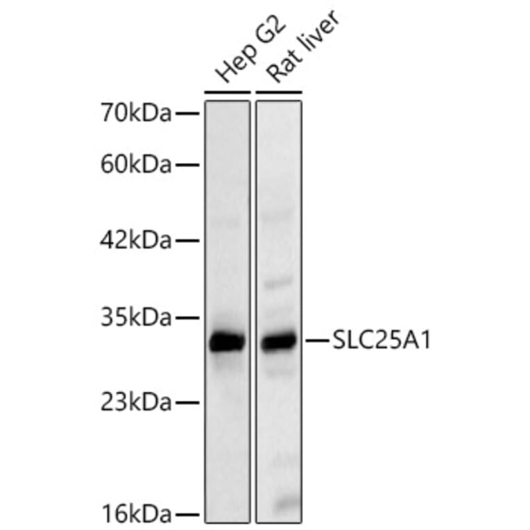 Western Blot - Anti-SLC25A1 Antibody (A329851) - Antibodies.com