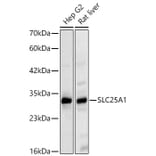 Western Blot - Anti-SLC25A1 Antibody (A329851) - Antibodies.com