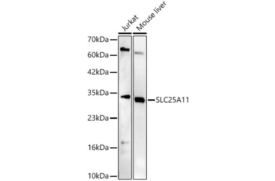 Western Blot - Anti-SLC25A11 Antibody (A329852) - Antibodies.com