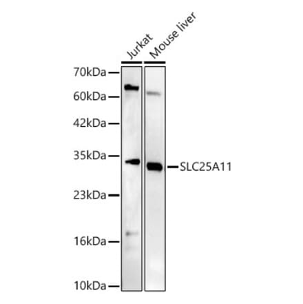 Western Blot - Anti-SLC25A11 Antibody (A329852) - Antibodies.com