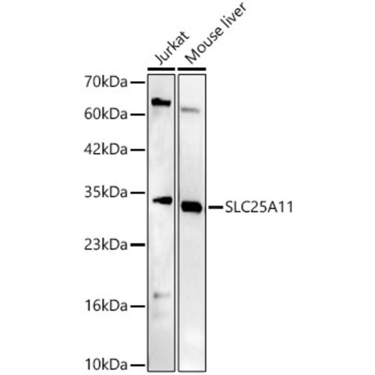 Western Blot - Anti-SLC25A11 Antibody (A329852) - Antibodies.com