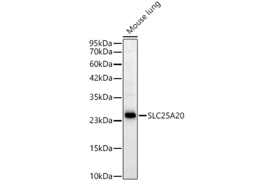 Western Blot - Anti-SLC25A20 Antibody [ARC59015] (A329853) - Antibodies.com