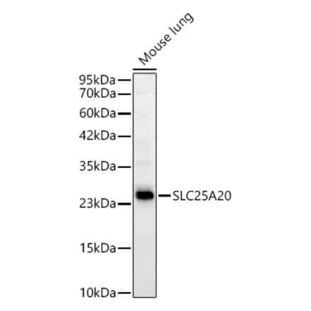 Western Blot - Anti-SLC25A20 Antibody [ARC59015] (A329853) - Antibodies.com