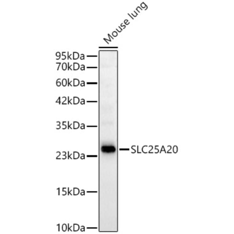Western Blot - Anti-SLC25A20 Antibody [ARC59015] (A329853) - Antibodies.com