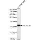 Western Blot - Anti-SLC25A20 Antibody [ARC59015] (A329853) - Antibodies.com