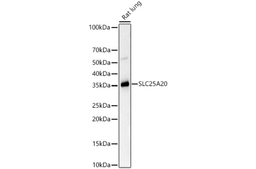 Western Blot - Anti-SLC25A20 Antibody [ARC59015] (A329853) - Antibodies.com