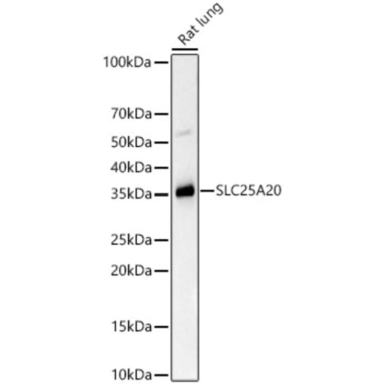 Western Blot - Anti-SLC25A20 Antibody [ARC59015] (A329853) - Antibodies.com
