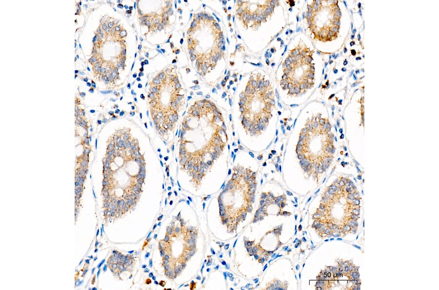 Immunohistochemistry - Anti-SLC25A29 Antibody (A329855) - Antibodies.com