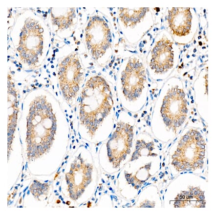 Immunohistochemistry - Anti-SLC25A29 Antibody (A329855) - Antibodies.com