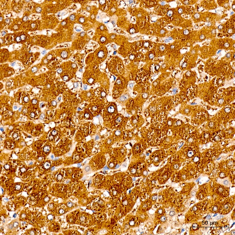 Immunohistochemistry - Anti-SLC25A29 Antibody (A329855) - Antibodies.com