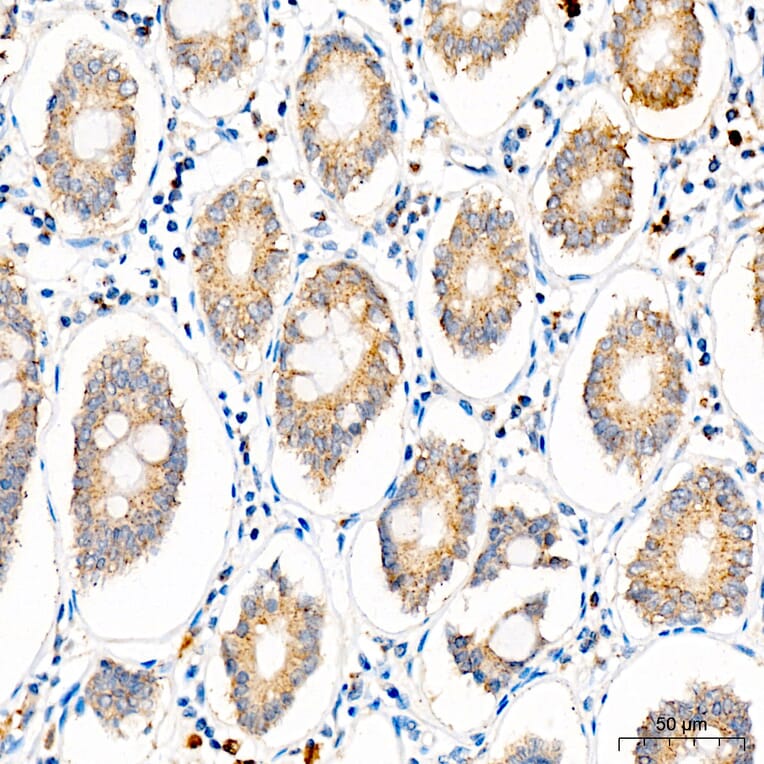 Immunohistochemistry - Anti-SLC25A29 Antibody (A329855) - Antibodies.com