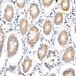 Immunohistochemistry - Anti-SLC25A29 Antibody (A329855) - Antibodies.com